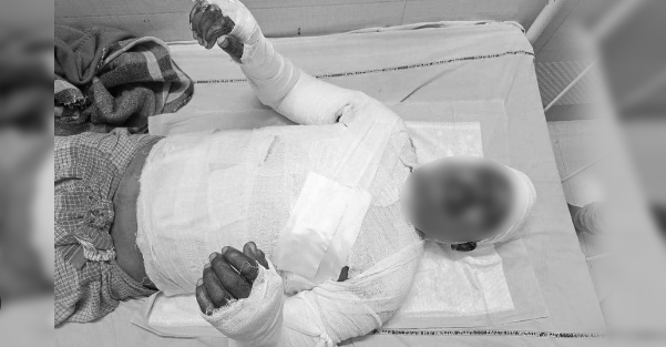 दुर्गा प्रसाईँका समर्थकले जलाएका ट्रक चालकको मृत्यु